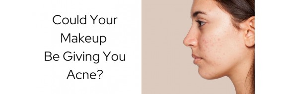 Could Your Makeup Be Giving You Acne?